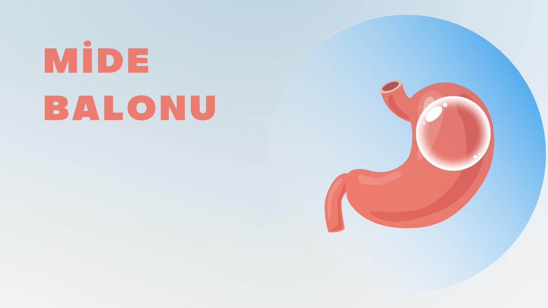 Mide Balonu Nedir?